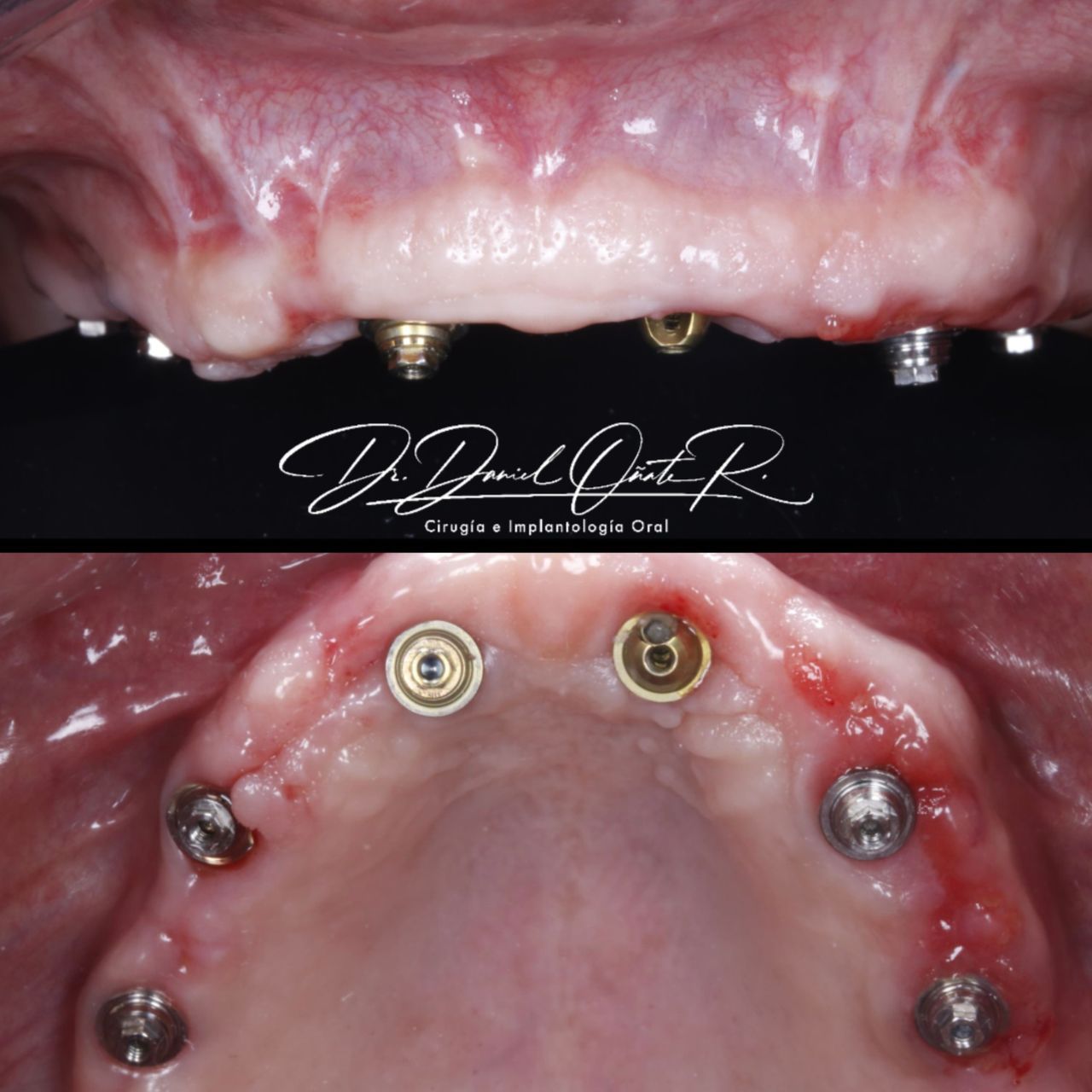 Daniel Oñate Robledo-4