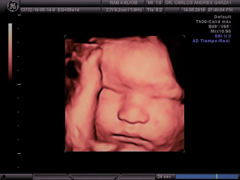 Carlos Andrés Garza Flores-4