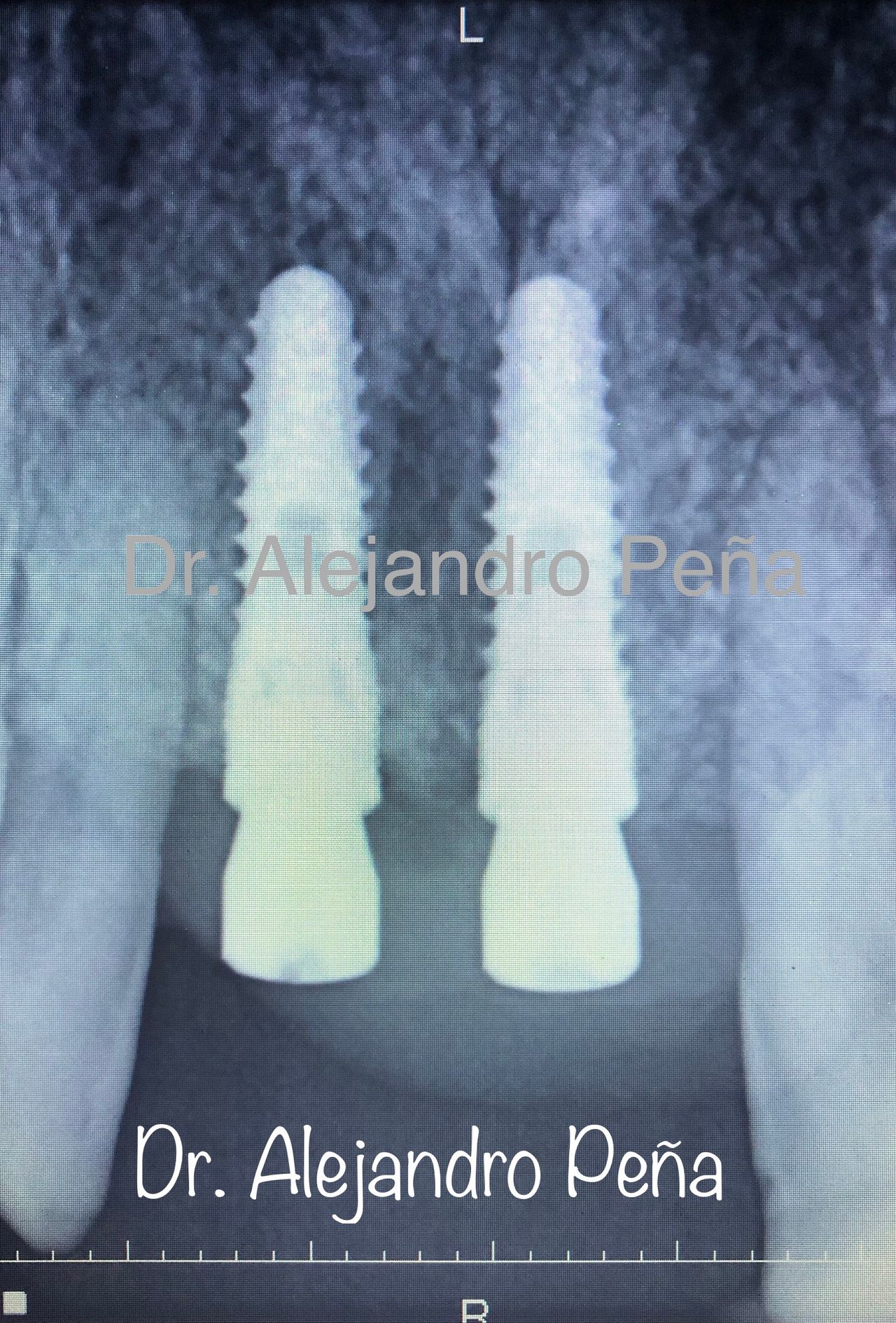 Alejandro Peña Vega-12