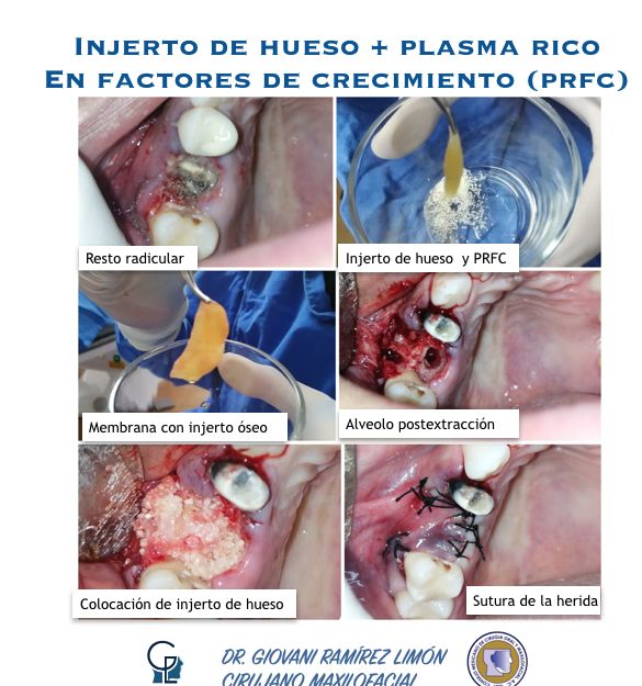 Giovani Ramírez Limón-36