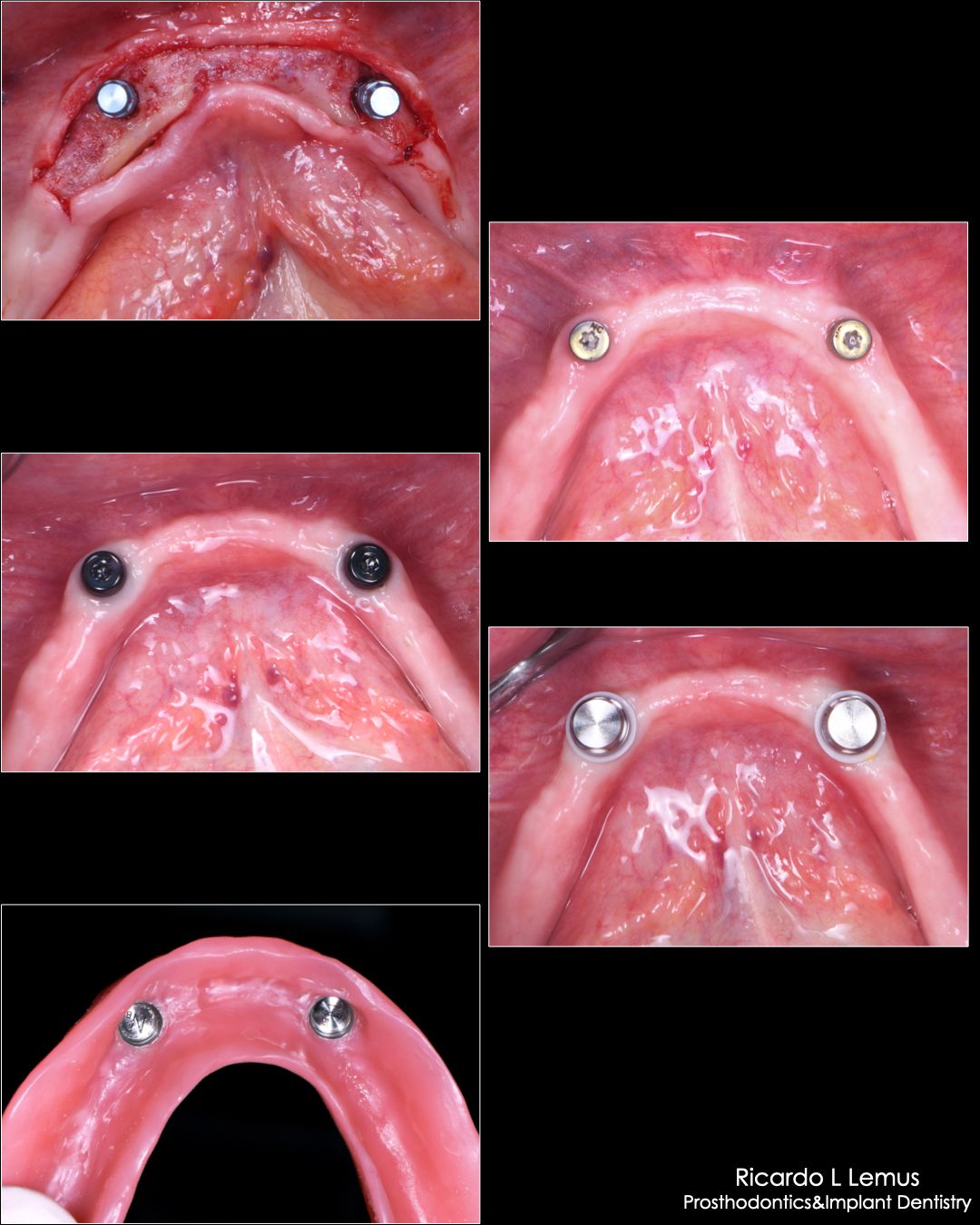 Ricardo López Lemus-103