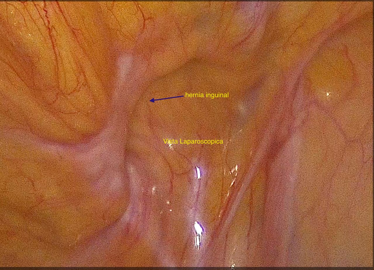 Juan Sergio Ramirez Rosas-4