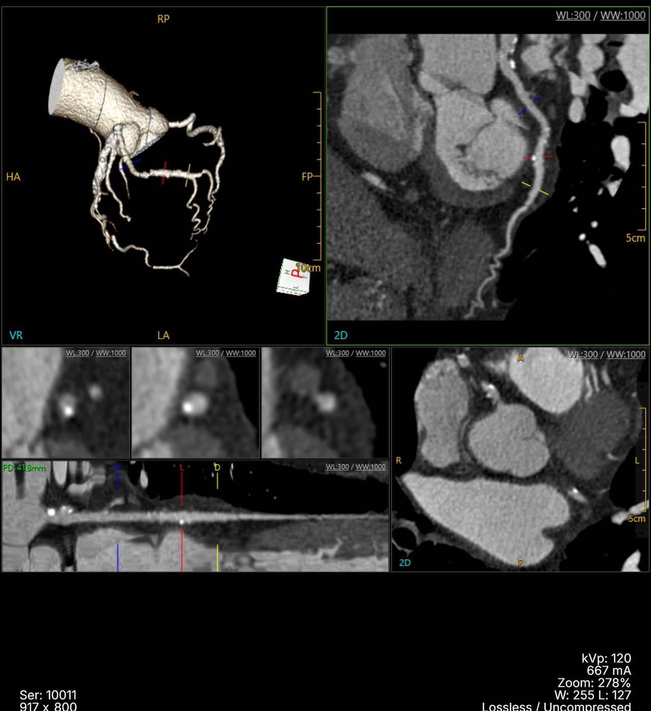 Iván A. Barreto Alanis-1