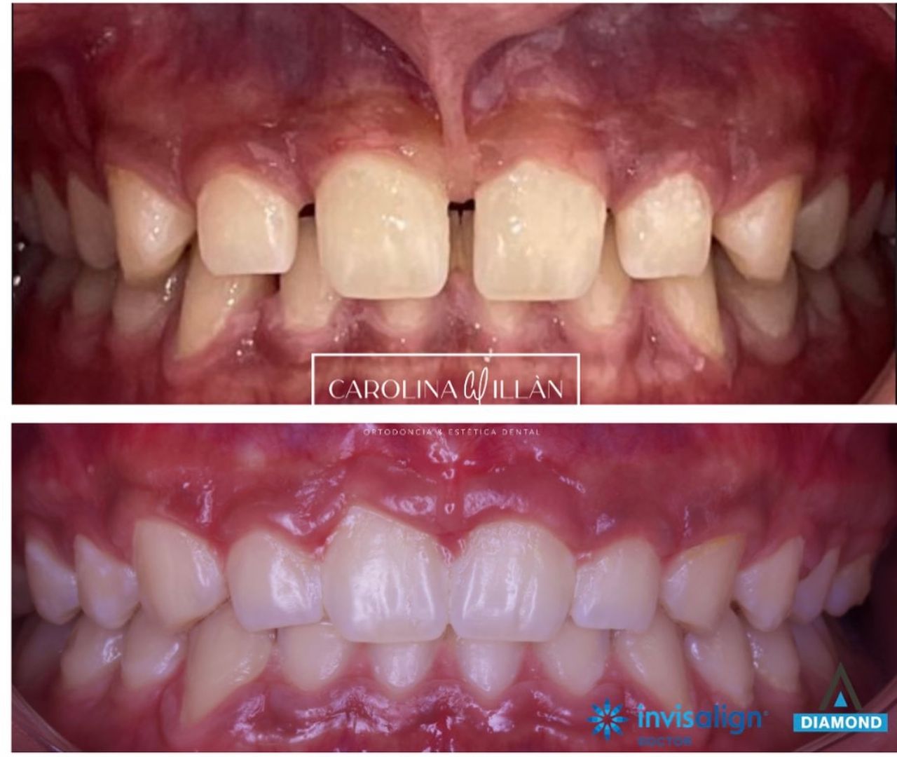 Diana Carolina Illán Gallardo-9