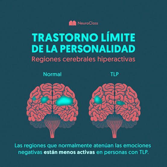 Elizabeth Rodriguez Bosch-14