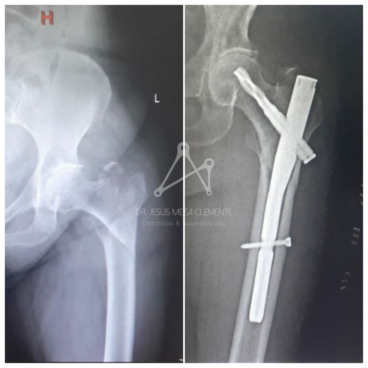 Jesus Octavio Meza Clemente-1