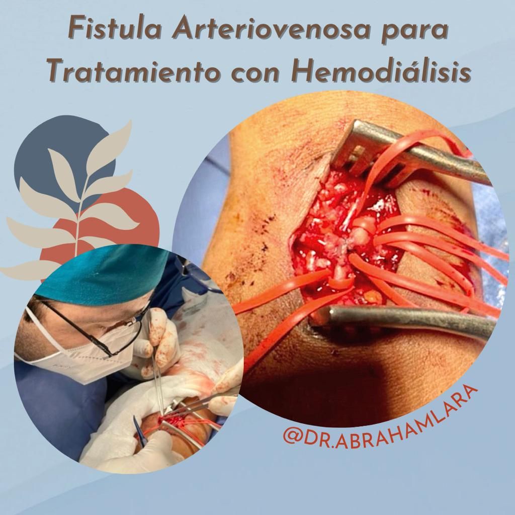 Miguel Abraham Lara Perez-20