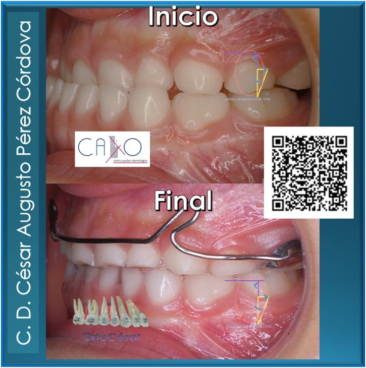 César Augusto Pérez Córdova-22