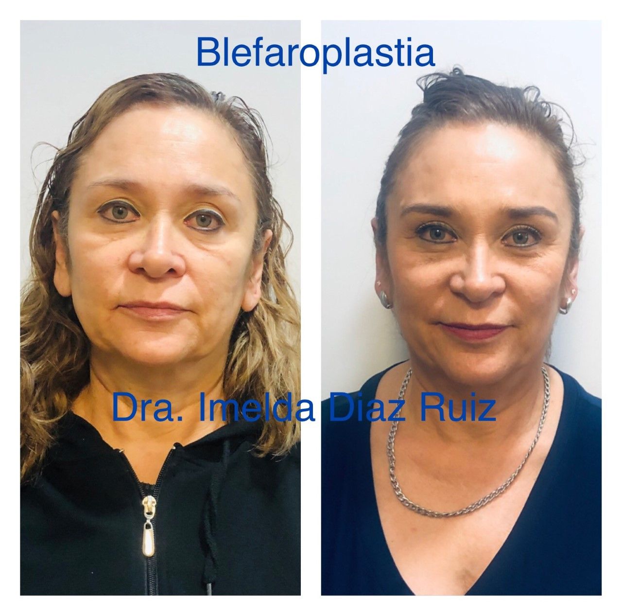 Imelda Díaz Ruiz-20