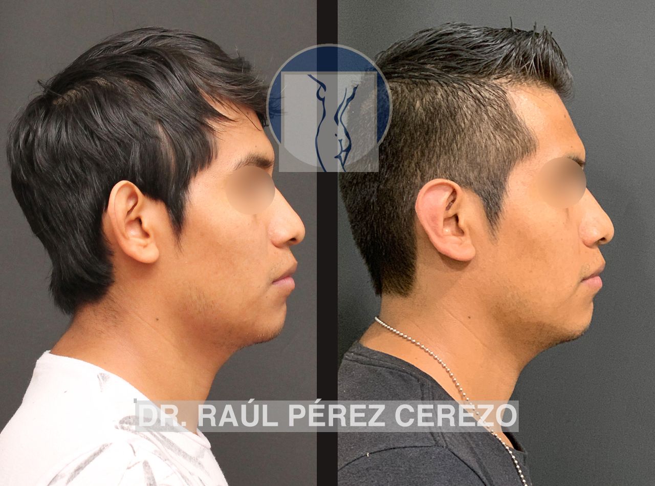 Raúl Pérez Cerezo-34