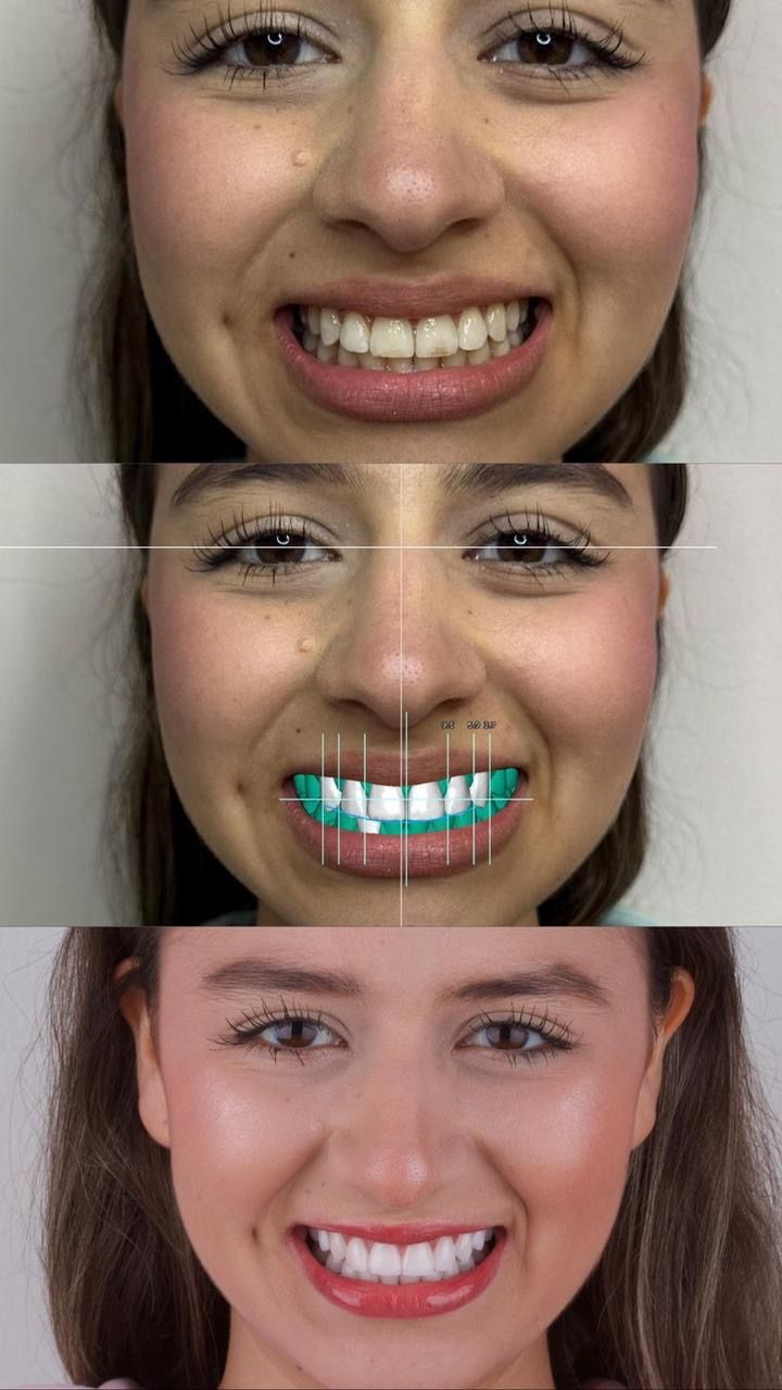 Mirely Peralta Rodríguez-16