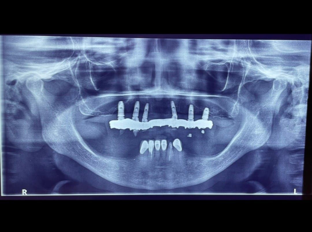 Carlos Ernesto Contreras Castellanos-24