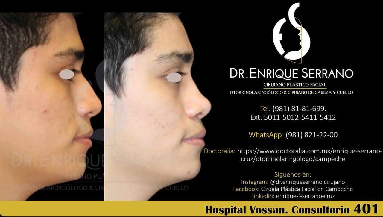 Enrique Serrano Cruz-122