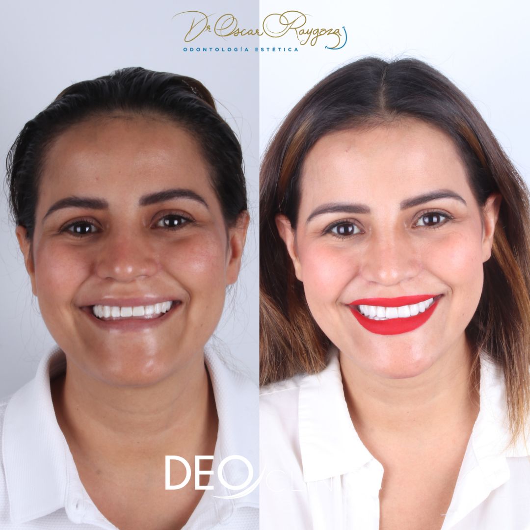 Oscar Raygoza Carrillo-20