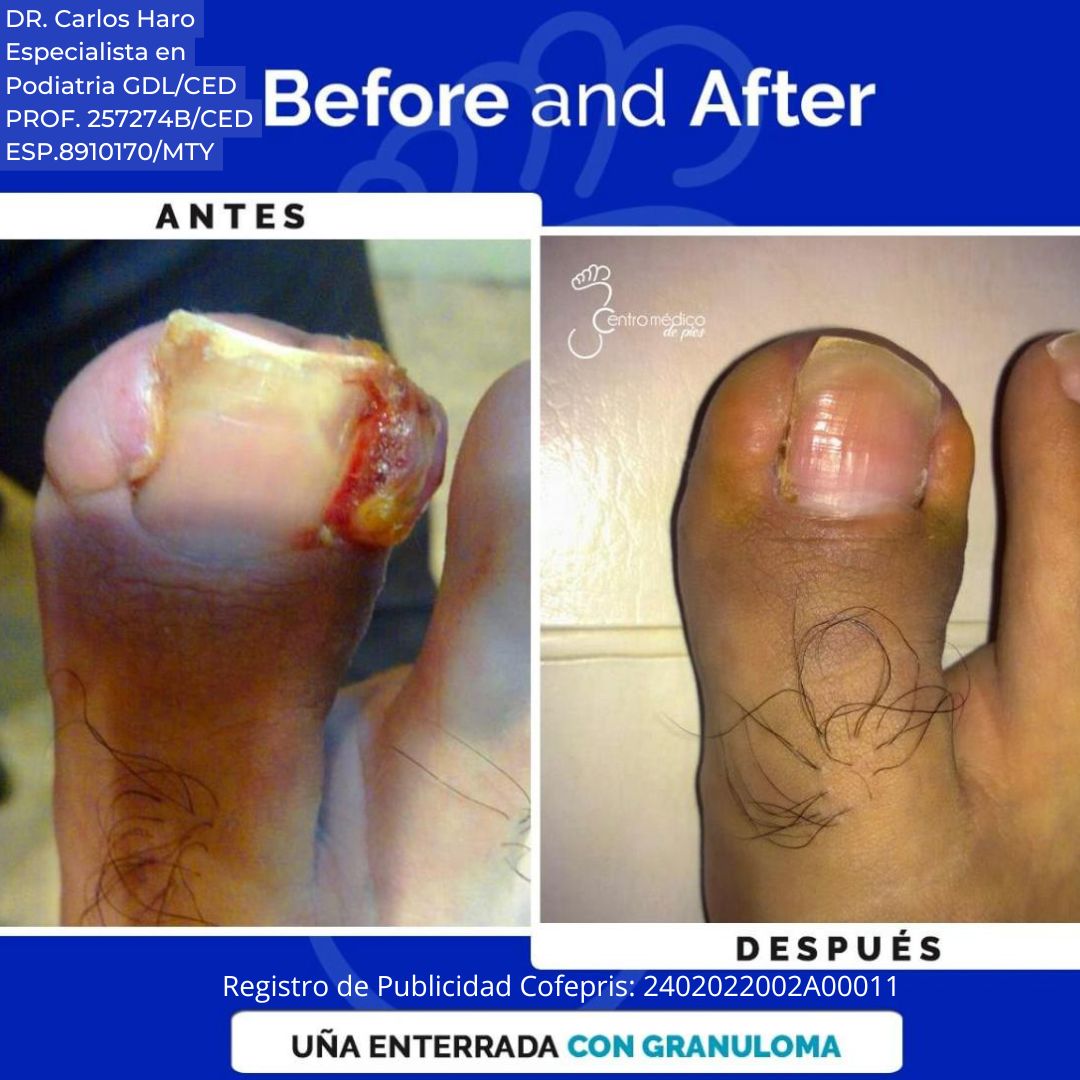 Carlos Alberto Haro Prieto-11