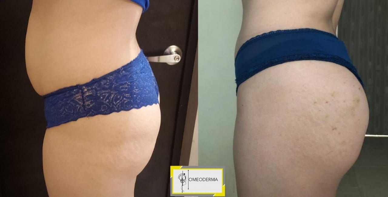 Gilliar Emmanuel Eudave De Lima-13