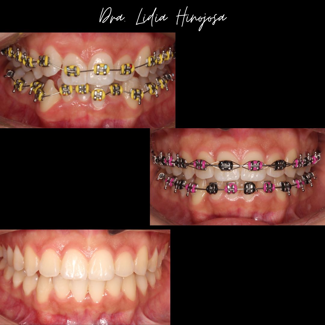 Lidia Abigail Hinojosa Arellanes-17