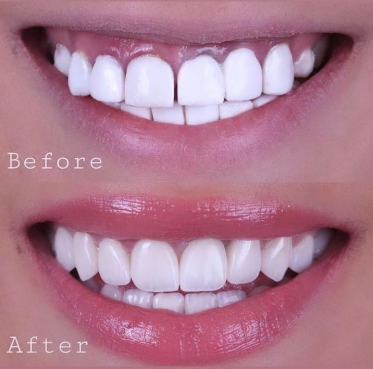 Victoria Eugenia Valderrama León-11