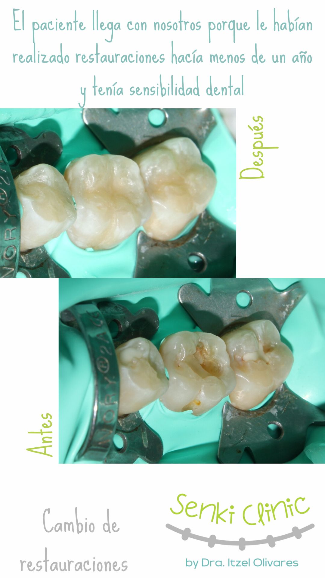 Itzel Olivares Lara-20