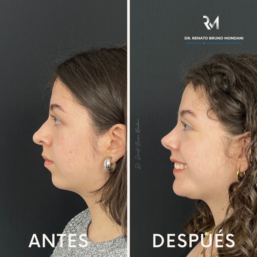 Renato Bruno Mondani-1