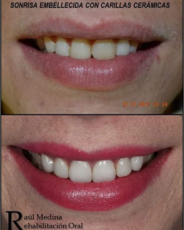 Raúl Uriel Medina Martinez-8