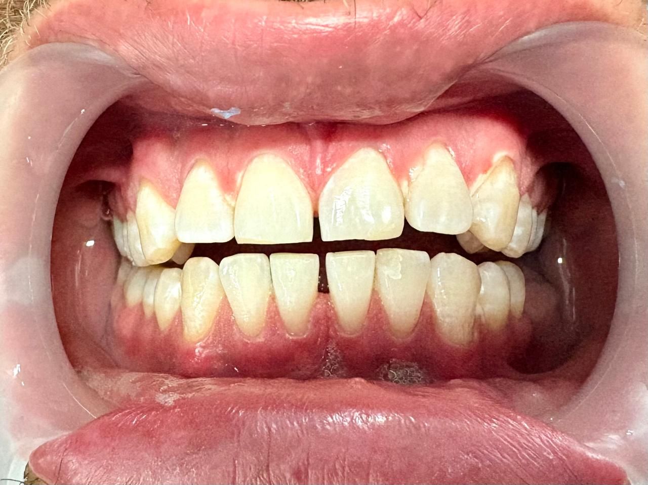 Arturo Romero Grande-35