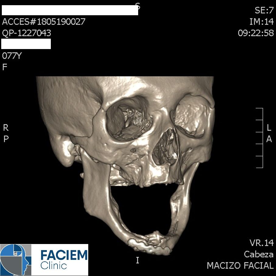 Arlen Colín Ordaz-52