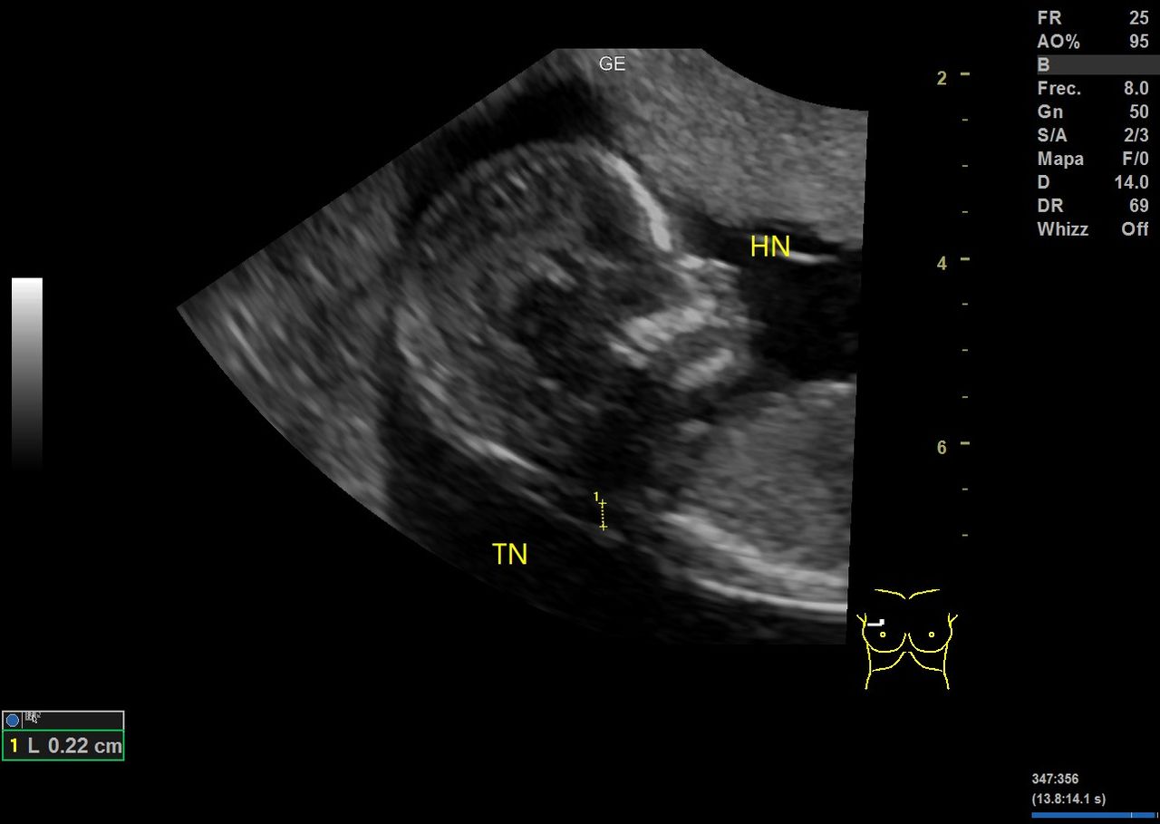 Graciela Elizabeth De La Torre Alvarez-21