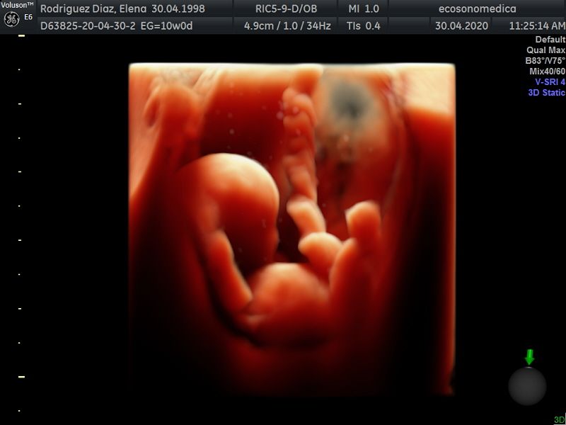 Héctor Bernardo Acevedo Manrique-10