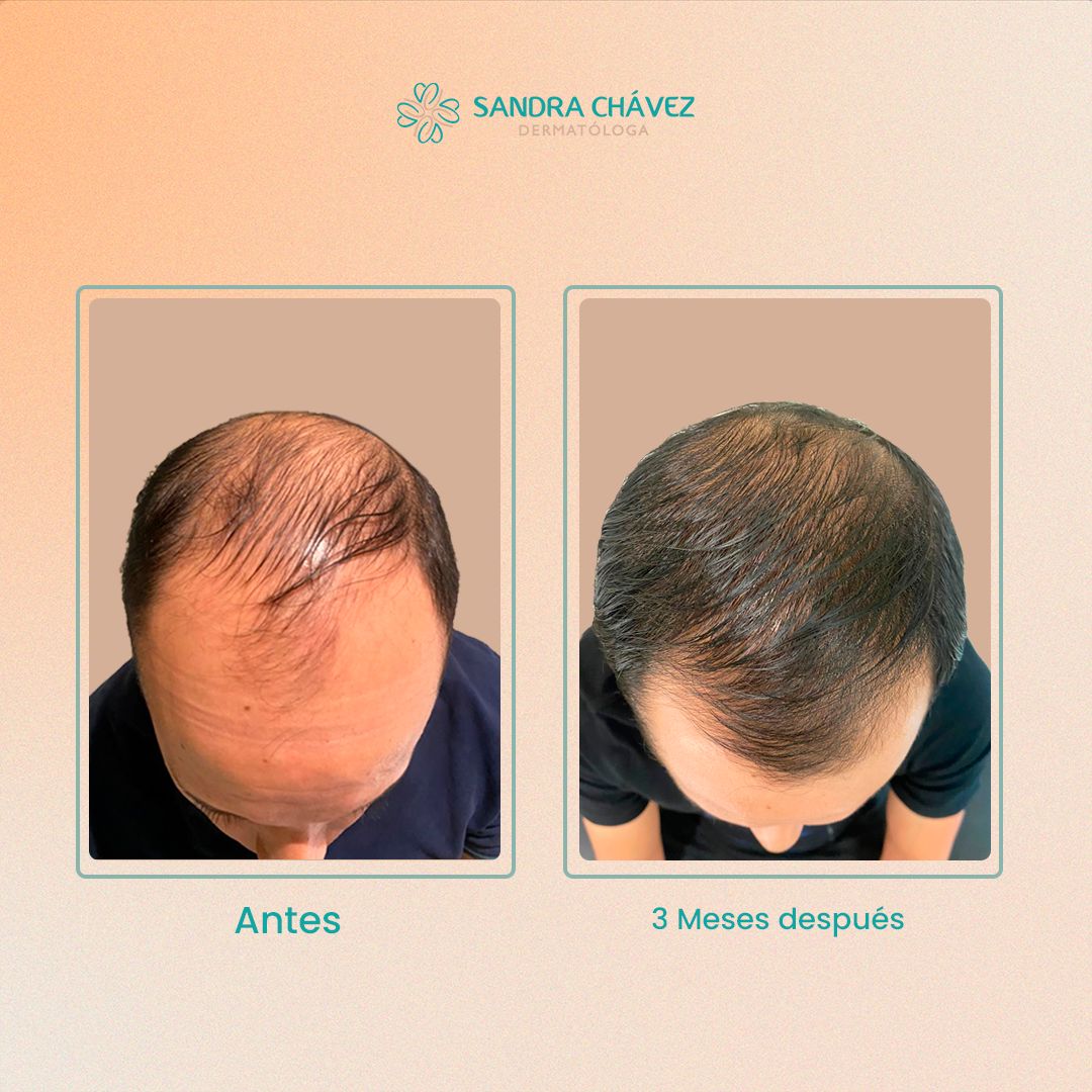 Sandra Lorena Chávez Landázuri-6