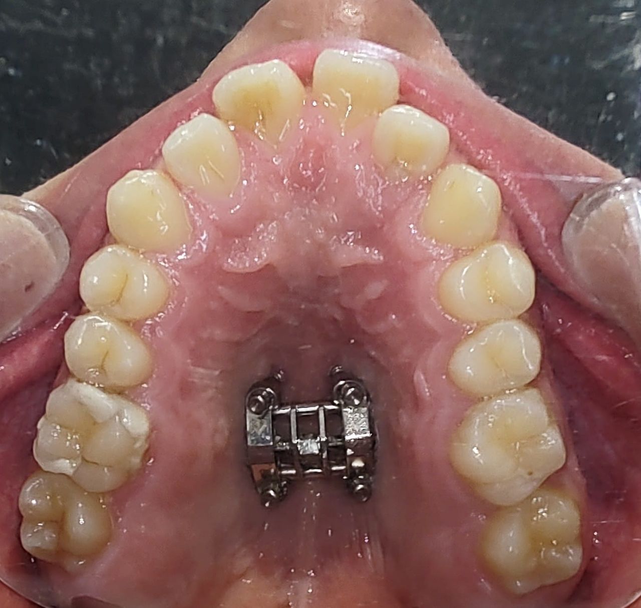 Aimée Quiroz Mendoza-23