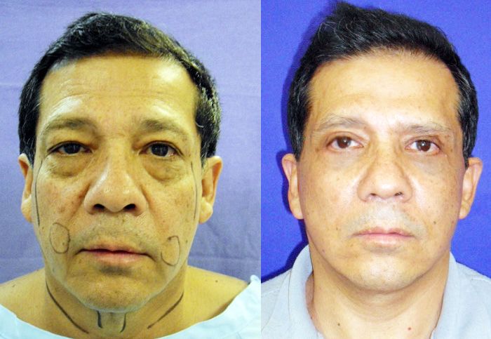 Carlos Gerardo Alfaro Moreno-24