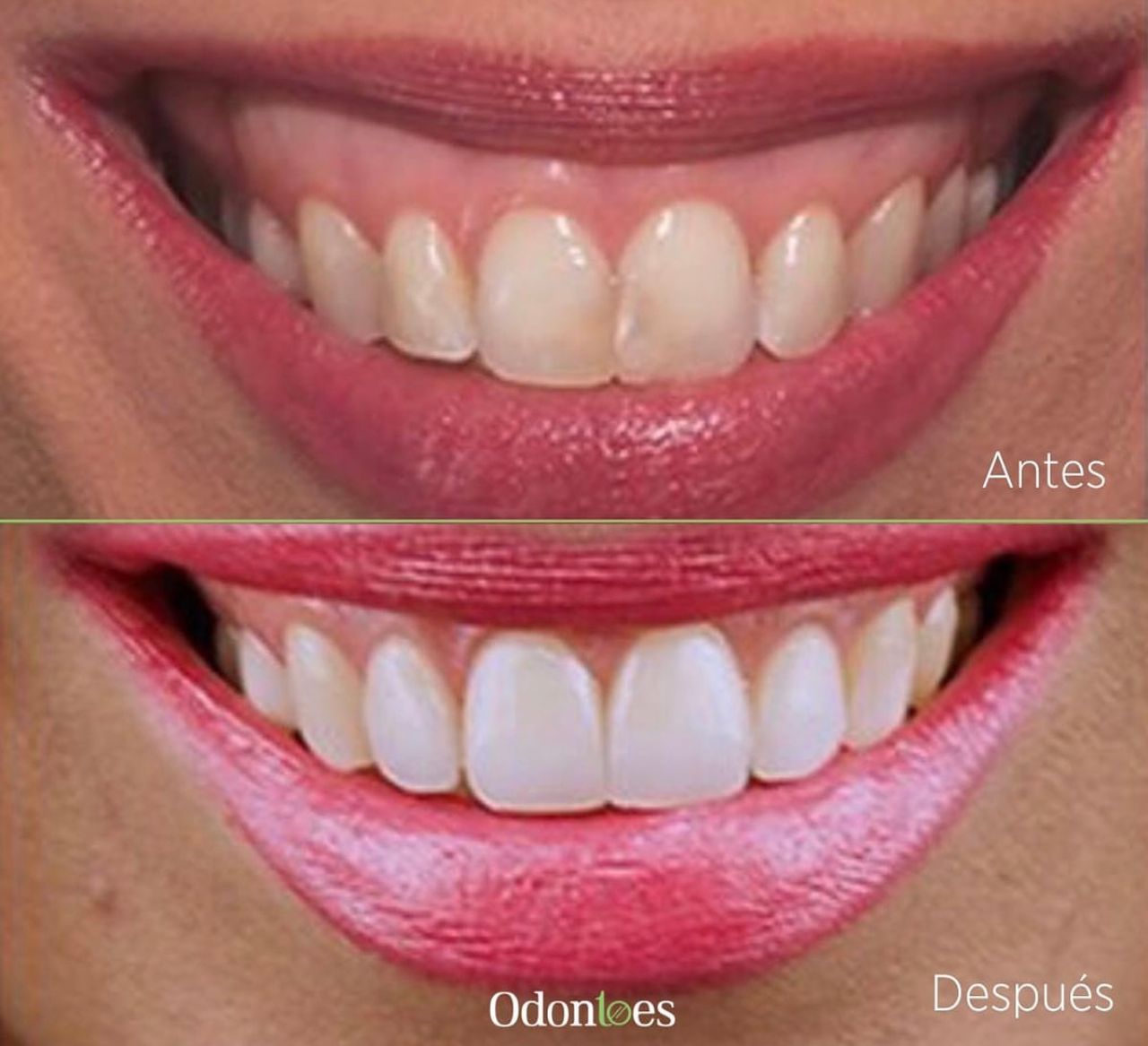 Raúl Euán Salazar-5