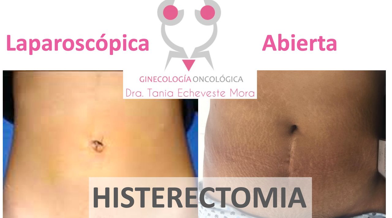 Tania Echeveste Mora-1