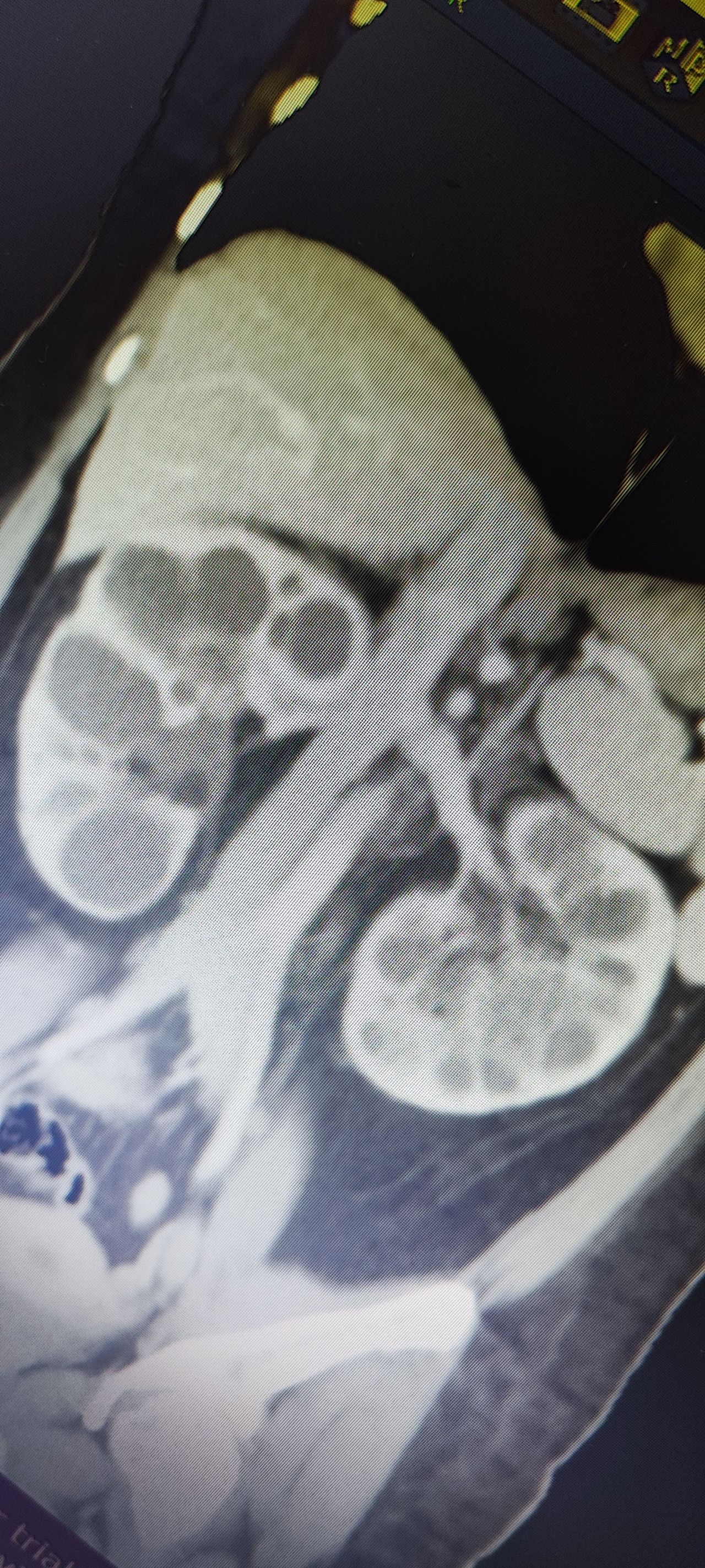 Krishna Marcos Escobar-5