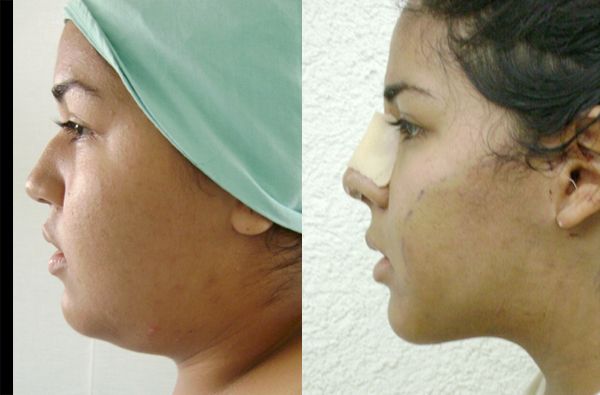 Edgar Ernesto Torres Mejía-9