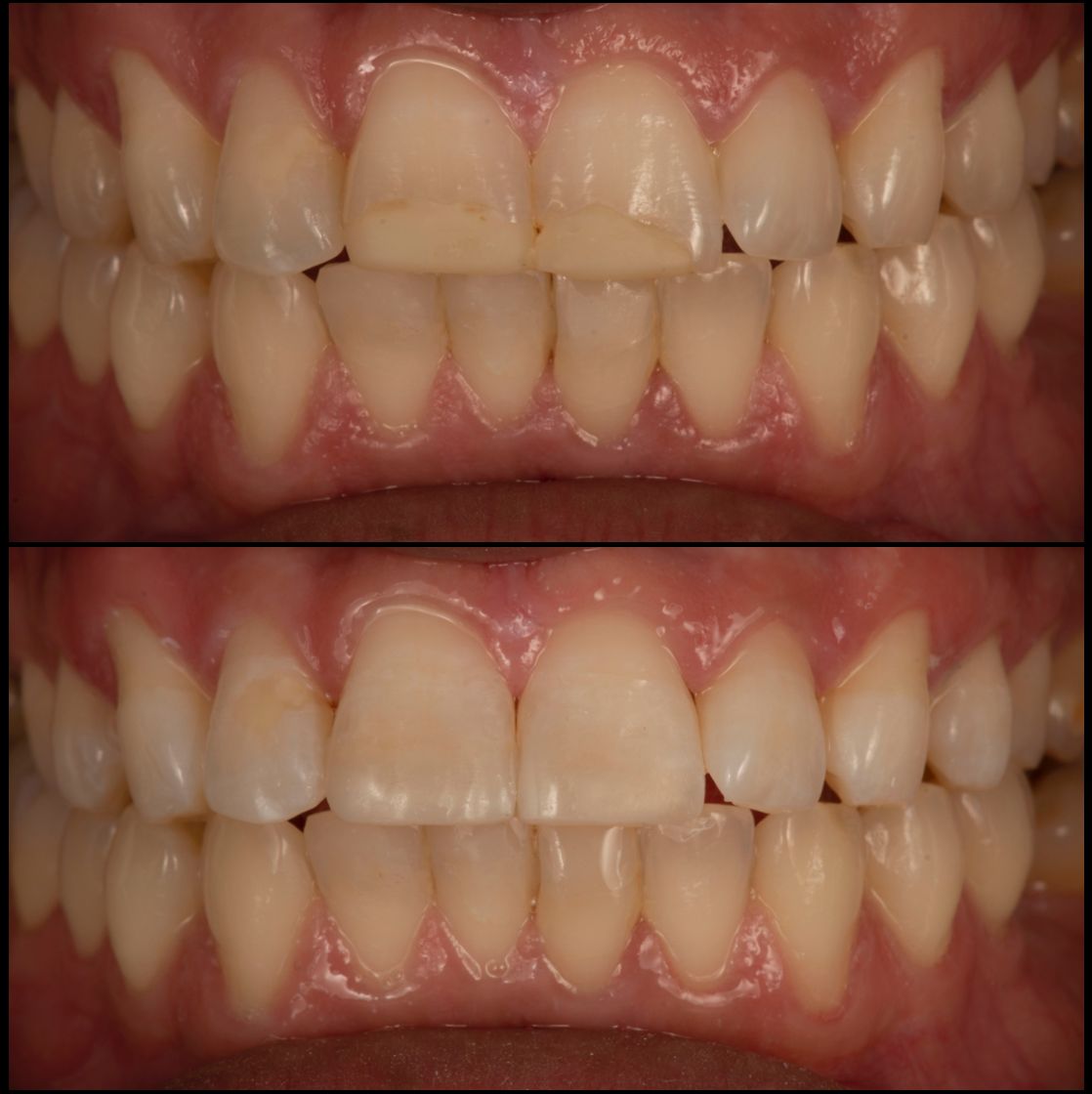 María Fernanda González Gastelum-38