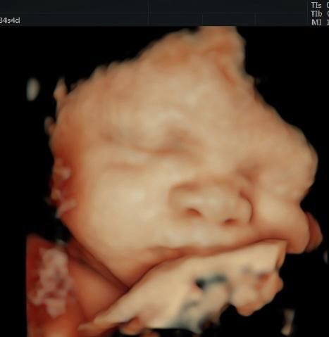 Katia Yareli Viera Ibarra-5