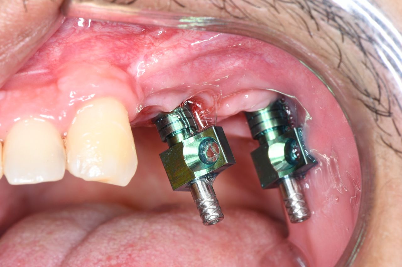 Fernando Ortiz Ortiz-0