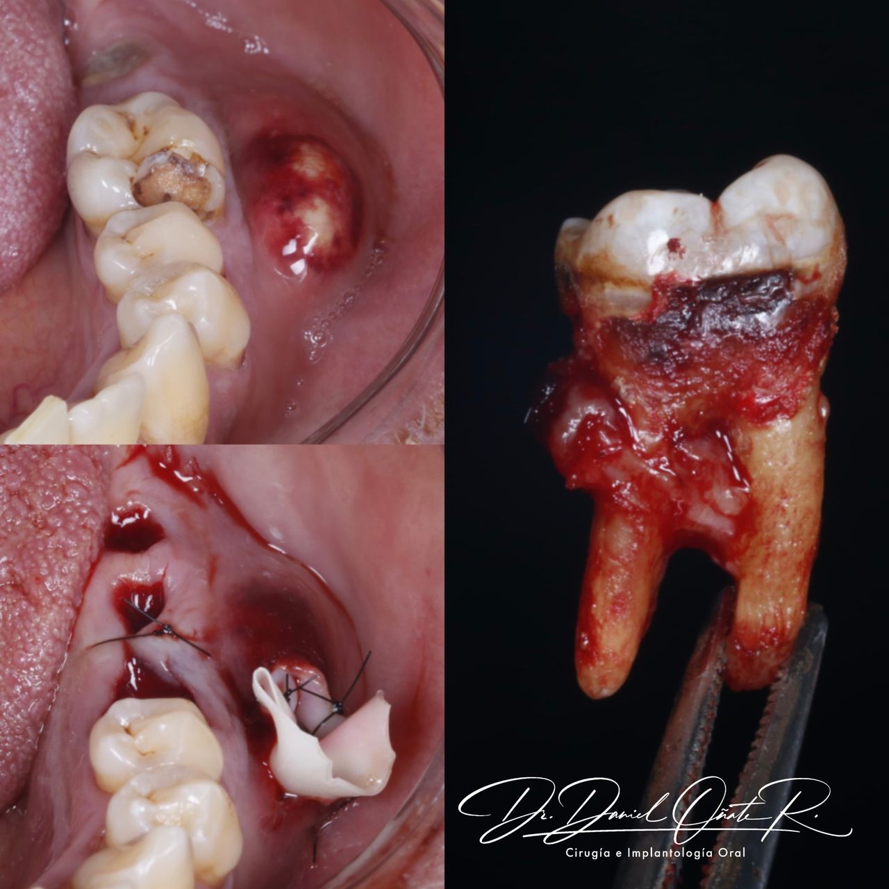 Daniel Oñate Robledo-7