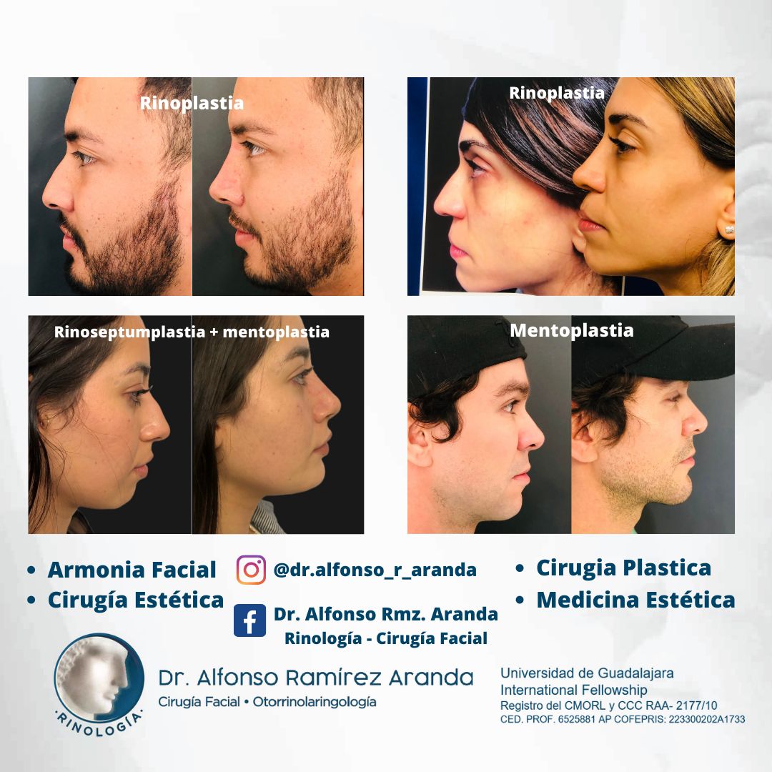 Alfonso Ramírez Aranda-1