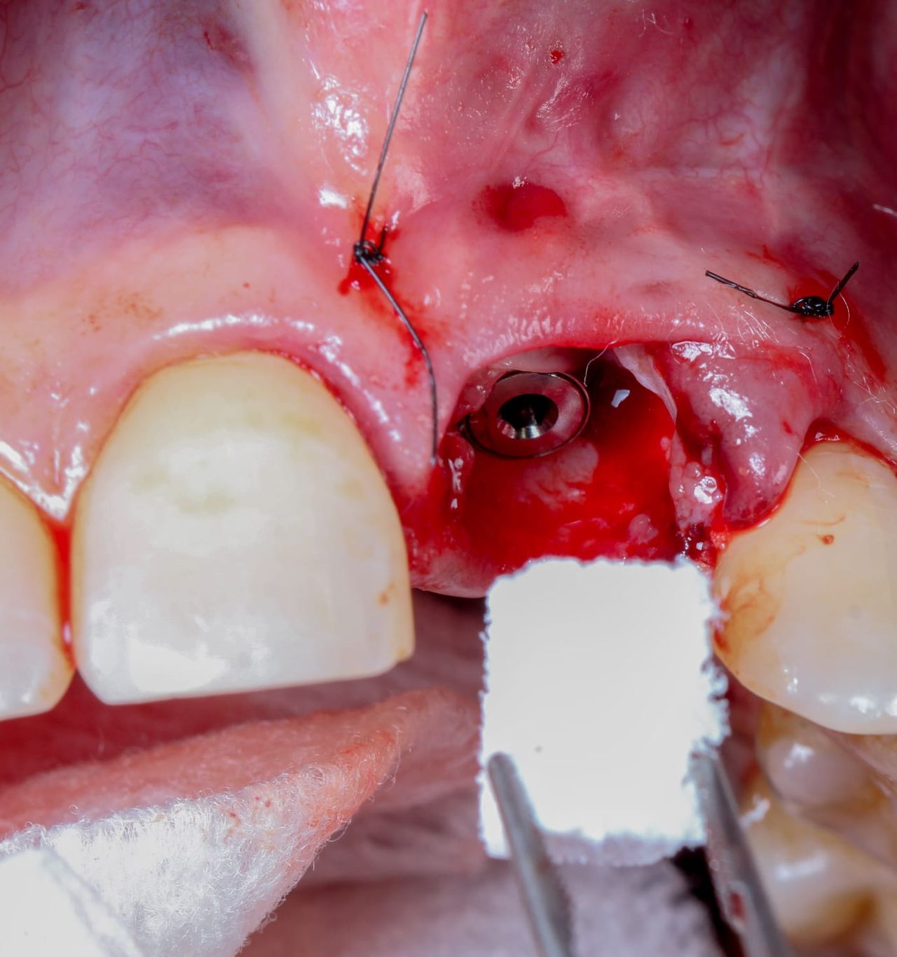 Hugo Enrique Aguilar Lamas-10