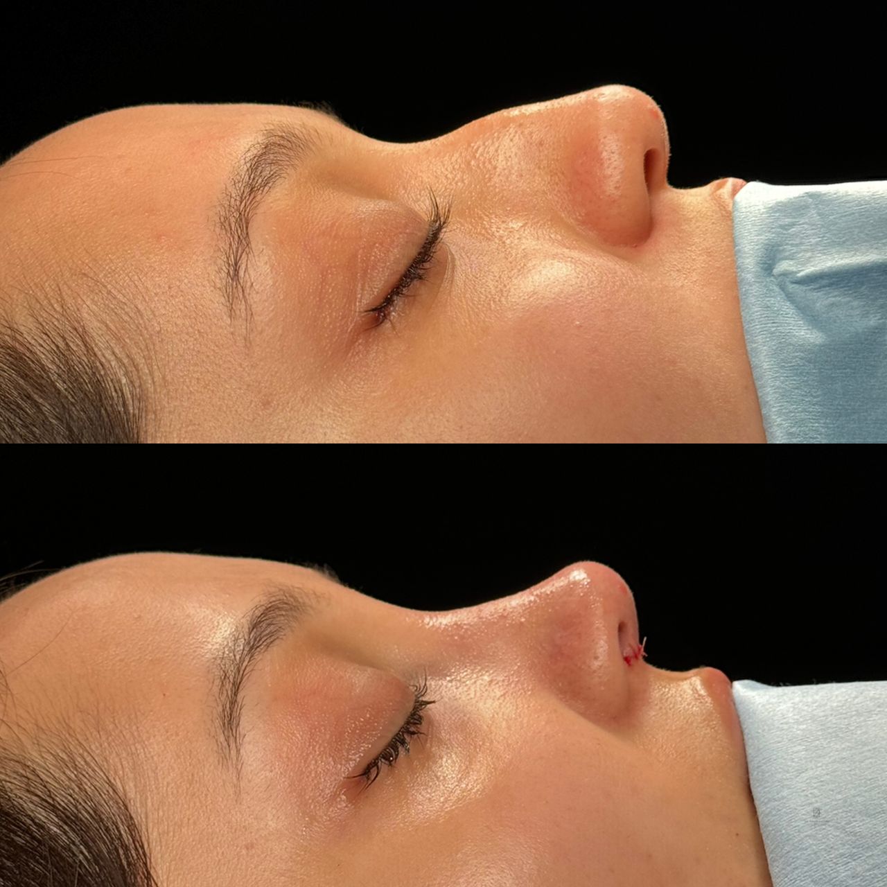 Angel Castro Urquizo-43