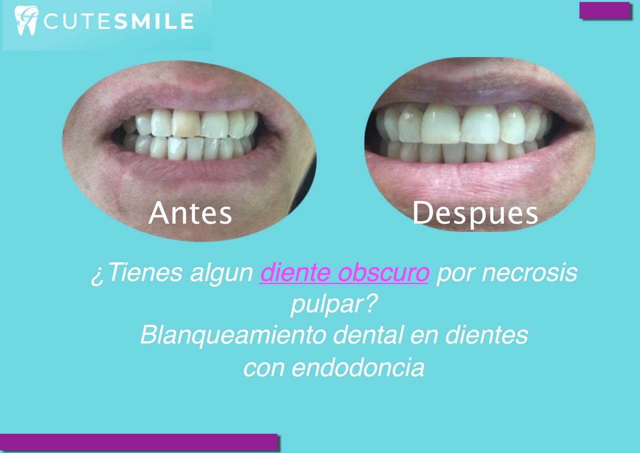 Georgina Zurita Rdz-5