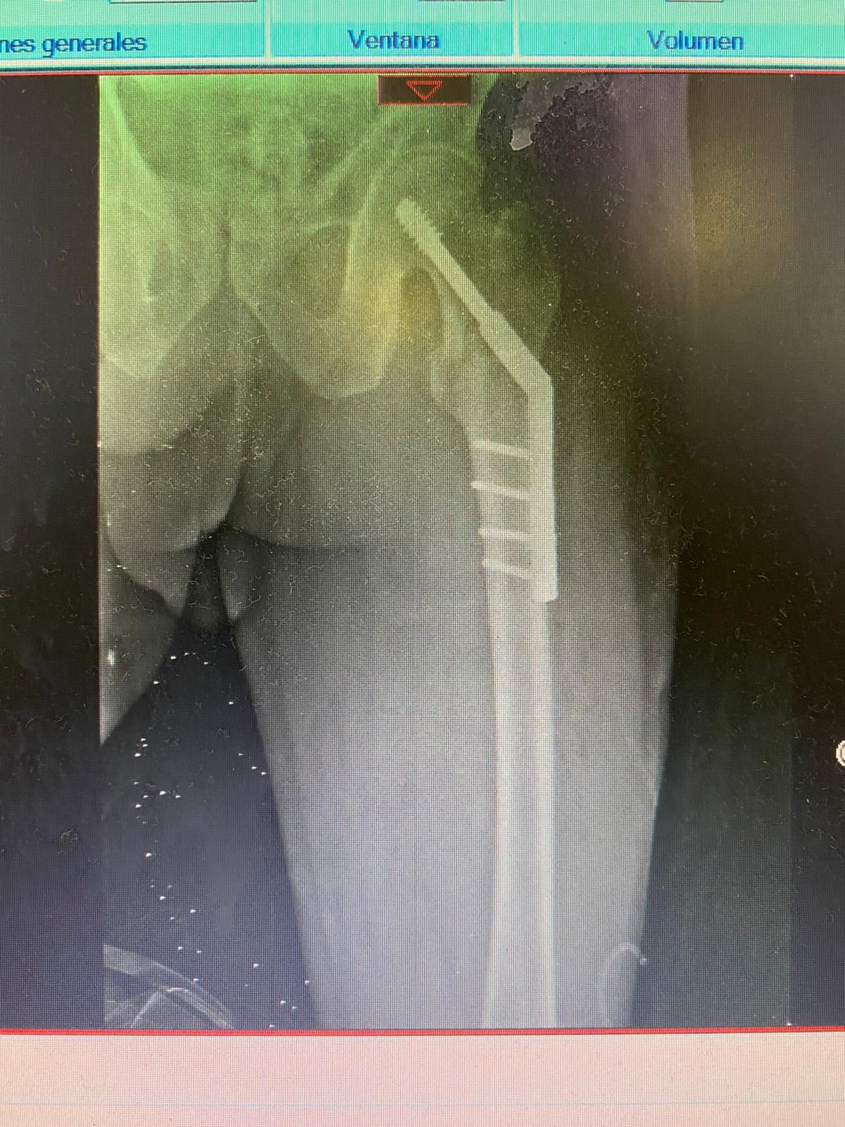 Juan José Luévano De La Cruz-44