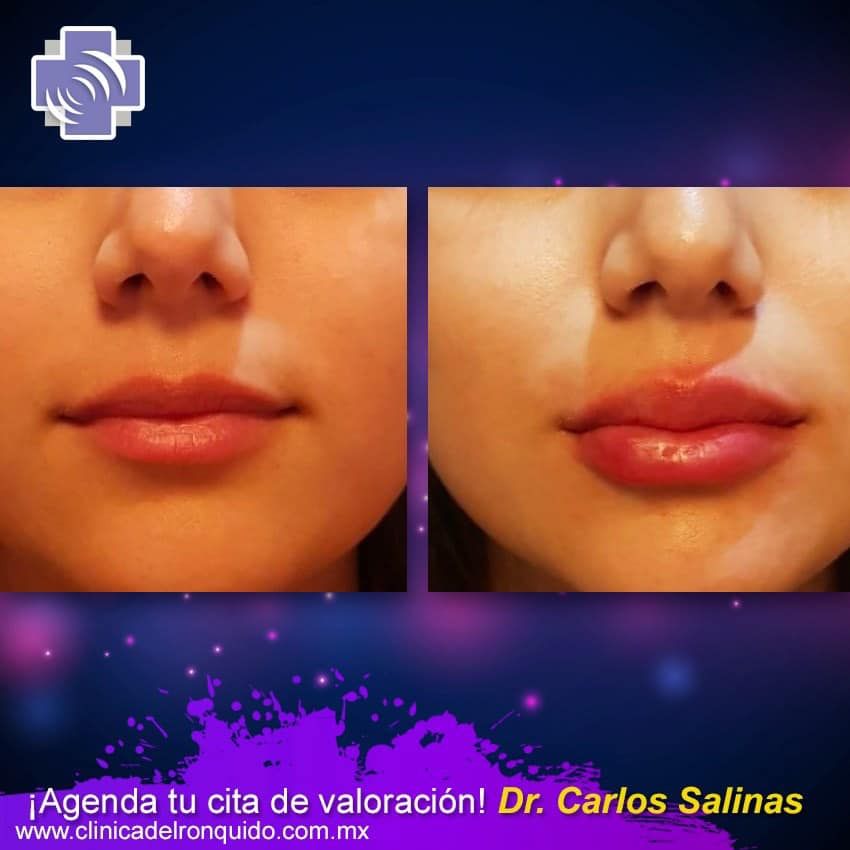 Carlos Salinas Camacho-12