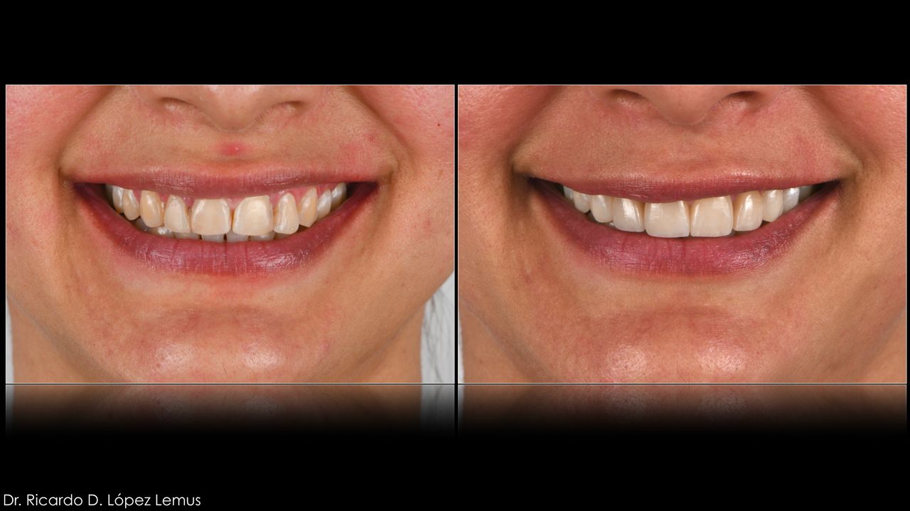 Ricardo López Lemus-84