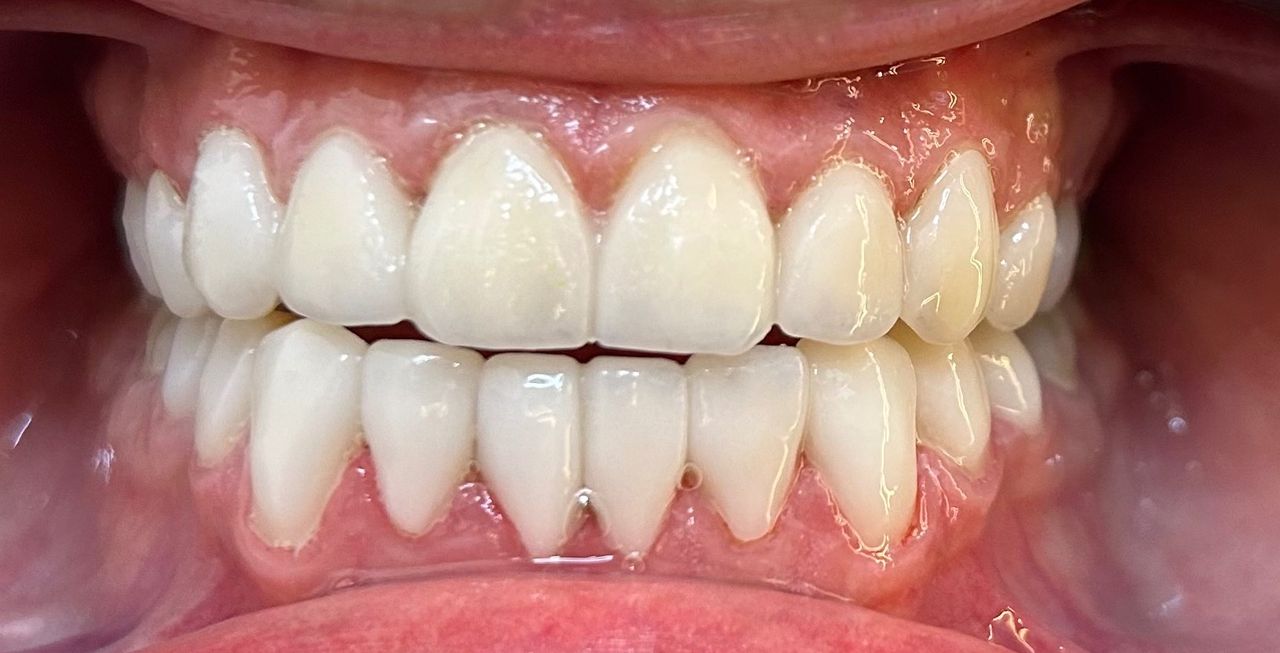 Mauricio Burgos Sánchez-11