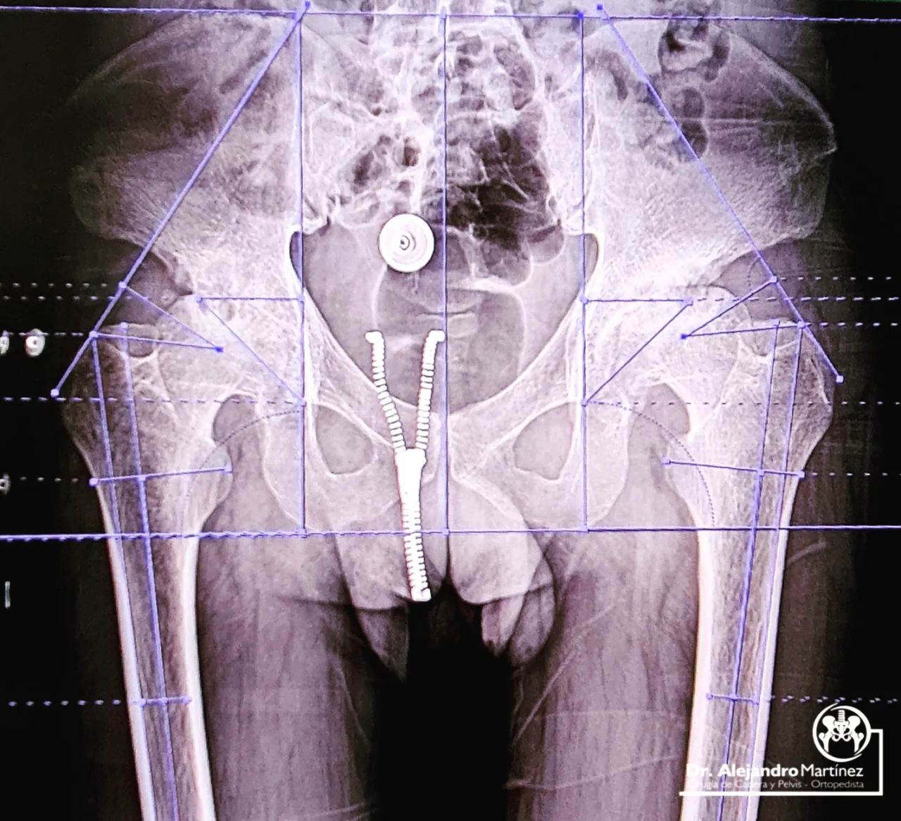 Alejandro Martínez Ramírez-27