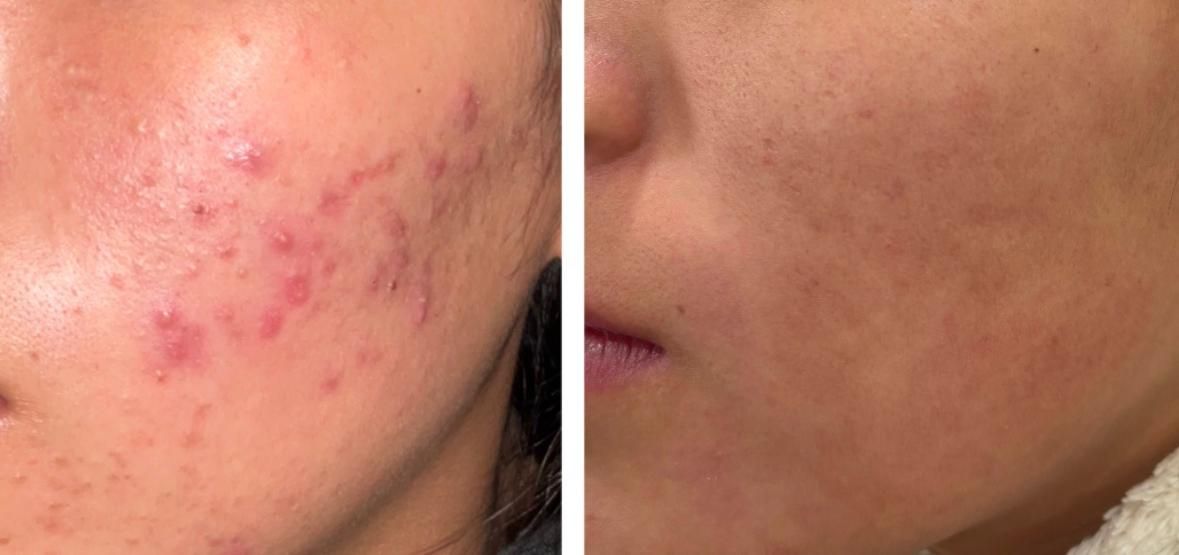 Pamela  Palacios Vega-0